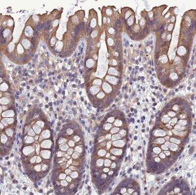 Immunohistochemistry-Paraffin: Galanin R2/GALR2 Antibody [NBP1-91921]