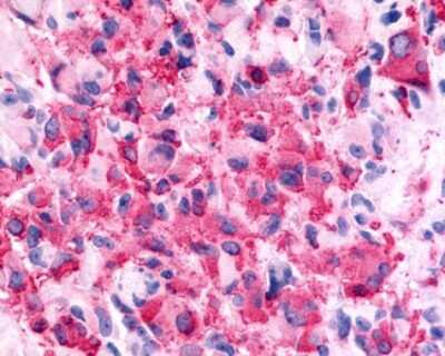 Immunohistochemistry-Paraffin: Galanin R2/GALR2 Antibody - BSA Free [NLS4156]