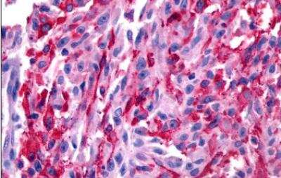 Immunohistochemistry-Paraffin: Galanin R2/GALR2 Antibody - BSA Free [NLS4156]