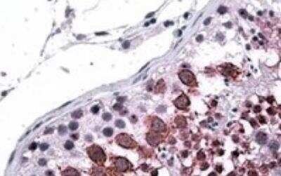 Immunohistochemistry-Paraffin: Galanin R3/GALR3 Antibody [NB100-2846]