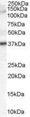 Western Blot: Galanin R3/GALR3 Antibody [NB100-2846]