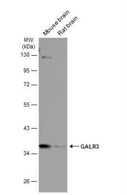 Western Blot: Galanin R3/GALR3 Antibody [NBP2-16577]