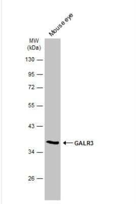 Western Blot: Galanin R3/GALR3 Antibody [NBP2-16577]