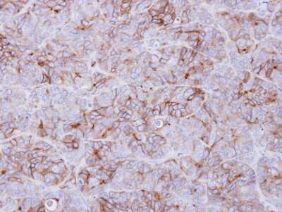 Immunohistochemistry-Paraffin: Galanin R3/GALR3 Antibody [NBP2-16577]