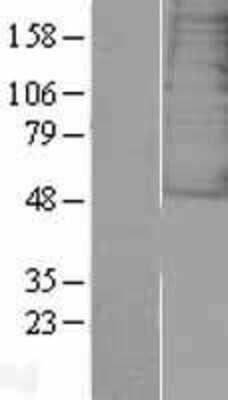 Western Blot: Galanin R3/GALR3 Overexpression Lysate [NBL1-10963]