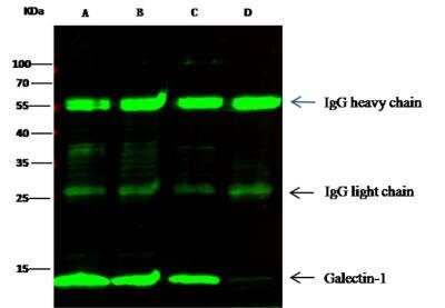 Immunoprecipitation: Galectin-1 Antibody (001) [NBP2-89387]