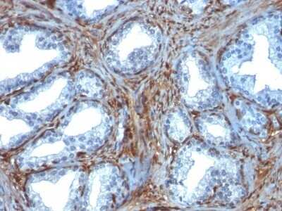 Immunohistochemistry-Paraffin: Galectin-1 Antibody (GAL1/1831) [NBP2-53212]