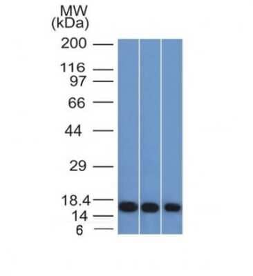 Western Blot: Galectin-1 Antibody (GAL1/1831) [NBP2-53212]