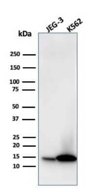 Western Blot: Galectin-1 Antibody (GAL1/1831) [NBP2-53212]