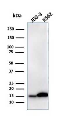 Western Blot: Galectin-1 Antibody (GAL1/2499R)Azide and BSA Free [NBP2-79855]