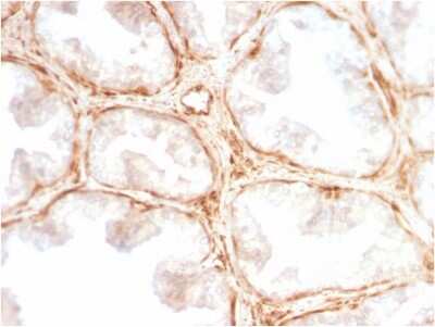 Immunohistochemistry-Paraffin: Galectin-1 Antibody (GAL1/2499R) [NBP2-79721]