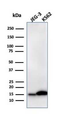 Western Blot: Galectin-1 Antibody (GAL1/2499R) [NBP2-79721]