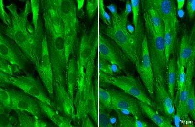 Immunocytochemistry/ Immunofluorescence: Galectin-1 Antibody [NBP2-16580]