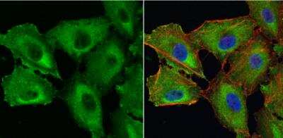 Immunocytochemistry/ Immunofluorescence: Galectin-1 Antibody [NBP2-16581]
