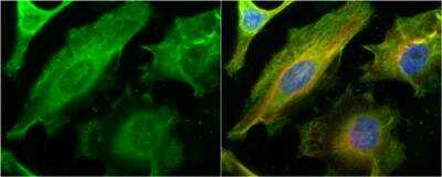 Immunocytochemistry/ Immunofluorescence: Galectin-1 Antibody [NBP2-16581]