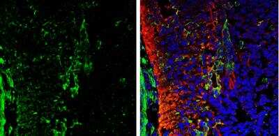 Immunohistochemistry-Frozen: Galectin-1 Antibody [NBP2-16580]