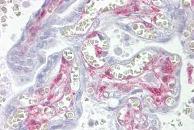 Immunohistochemistry-Paraffin: Galectin-1 Antibody [NBP1-59002]