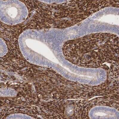 Immunohistochemistry-Paraffin: Galectin-1 Antibody [NBP1-89791]