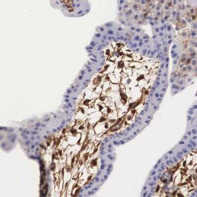 Immunohistochemistry-Paraffin: Galectin-1 Antibody [NBP1-89791]
