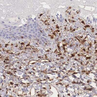 Immunohistochemistry-Paraffin: Galectin-1 Antibody [NBP1-89791]