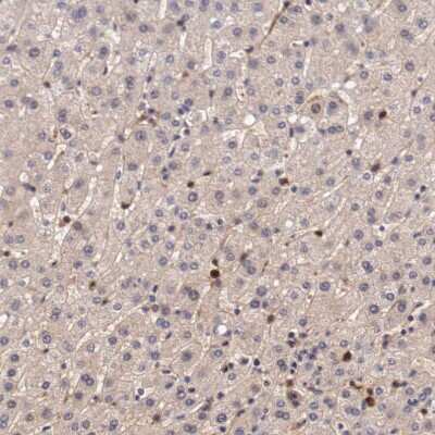 Immunohistochemistry-Paraffin: Galectin-1 Antibody [NBP1-89791]