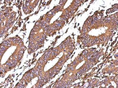Immunohistochemistry-Paraffin: Galectin-1 Antibody [NBP2-16580]