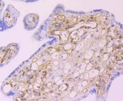 Immunohistochemistry-Paraffin: Galectin-1 Antibody (JM13-37) [NBP2-75499]