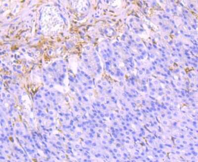 Immunohistochemistry-Paraffin: Galectin-1 Antibody (JM13-37) [NBP2-75499]