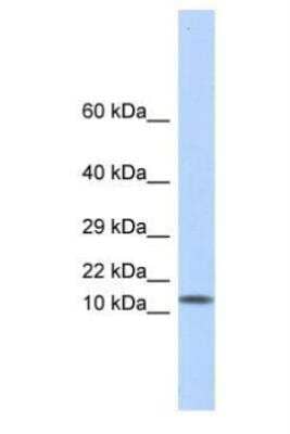 Western Blot: Galectin-1 Antibody [NBP1-59002]