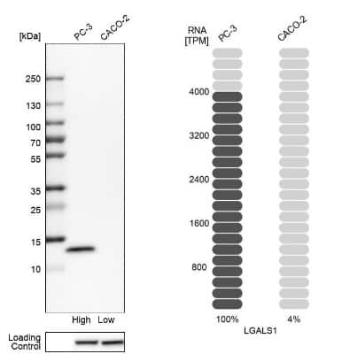 Western Blot: Galectin-1 Antibody [NBP1-89791]