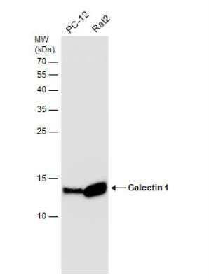Western Blot: Galectin-1 Antibody [NBP2-16580]