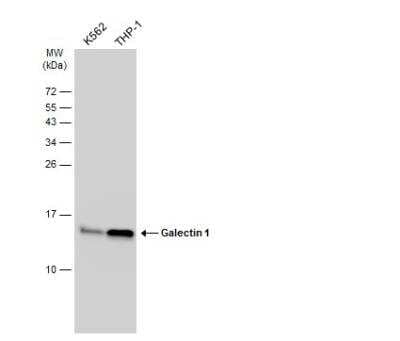 Western Blot: Galectin-1 Antibody [NBP2-16580]