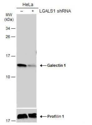 Western Blot: Galectin-1 Antibody [NBP2-16580]