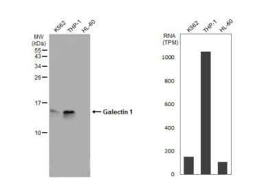 Western Blot: Galectin-1 Antibody [NBP2-16580]