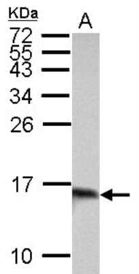 Western Blot: Galectin-1 Antibody [NBP2-16581]