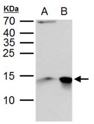 Western Blot: Galectin-1 Antibody [NBP2-16581]