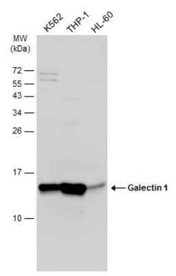 Western Blot: Galectin-1 Antibody [NBP2-16581]