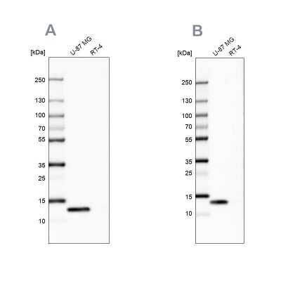 Western Blot: Galectin-1 Antibody [NBP2-76490]