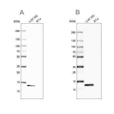 Western Blot: Galectin-1 Antibody [NBP2-76499]