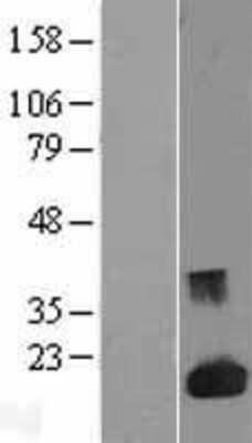 Western Blot: Galectin-1 Overexpression Lysate [NBL1-12496]