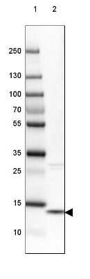 Western Blot: Galectin-10 Antibody [NBP1-87688]