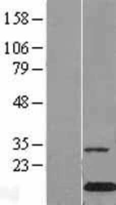 Western Blot: Galectin-10 Overexpression Lysate [NBL1-09226]