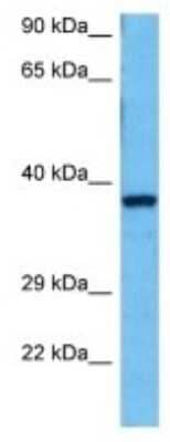 Western Blot: Galectin-12 Antibody [NBP3-10172]