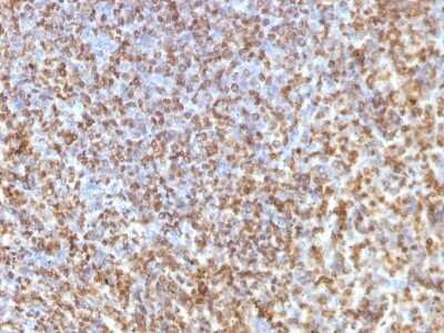 Immunohistochemistry-Paraffin: Galectin 13 Antibody (PP13/1161) - Azide and BSA Free [NBP2-54358]