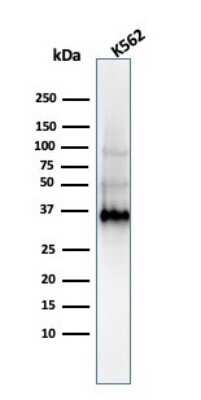 Western Blot: Galectin 13 Antibody (PP13/1161)Azide and BSA Free [NBP2-54358]