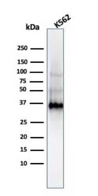 Western Blot: Galectin 13 Antibody (PP13/1161) [NBP2-53210]