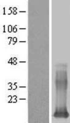 Western Blot: Galectin 13 Overexpression Lysate [NBL1-12498]