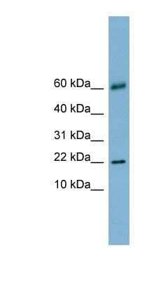 Western Blot: Galectin-14/LGALS14 Antibody [NBP1-57683]