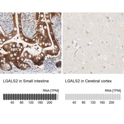 Immunohistochemistry-Paraffin: Galectin-2 Antibody [NBP1-89690]