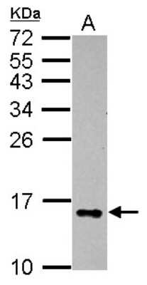 Western Blot: Galectin-2 Antibody [NBP2-16582]